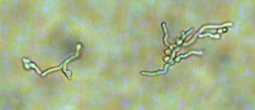 A seguir, 3,0 x 10 6 células de leveduras (100 μl) foram inoculadas em 5 Erlenmeyers contendo 50 ml de Caldo MPL e em 5 Erlenmeyers contendo 50 ml do mesmo caldo com 10 5 esporos de fungo teste,