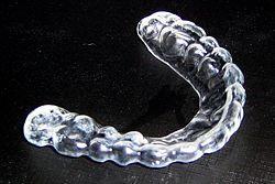 Férulas As Férulas dentárias são dispositivos feitos por técnicos de prótese dentária, fabricadas em resinas plásticas ou acrílicas, que cobrem toda ou parte das