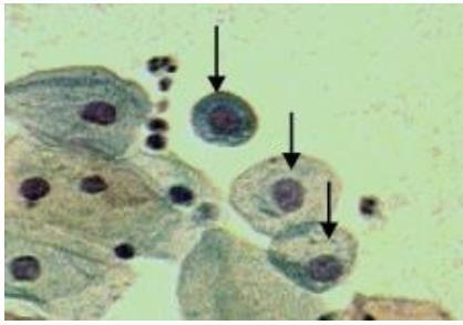 A presença dessas células é muito comum nos casos de atrofia ou de condições anormais, e elas têm uma efetiva atividade mitótica (ELEUTÉRIO JÚNIOR, 2003; SILVA NETO, 2012).
