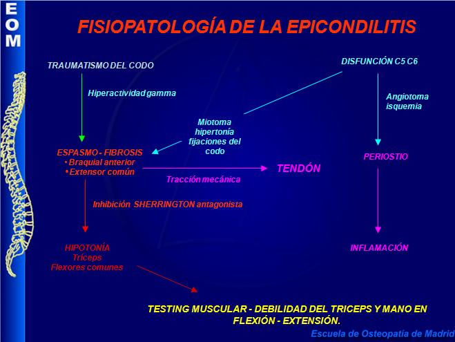 Classificação das tendinites. Tipo 1 ao 6. Higroma do cotovelo. Diagnóstico da epicondilite As alterações patológicas de punho, ombro e coluna cervical podem produzir sintomas reflexos de cotovelo.