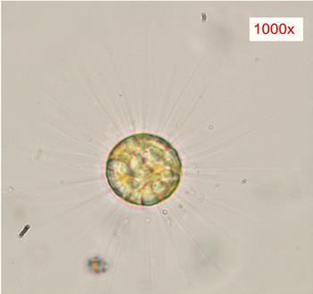 111 Figura 6.3: Microscopia óptica de Golenkinia radiata Chodat, 1894 em aumento de 1000x. Autor da foto: Pâmela Miranda (UFES). Tucci et al.