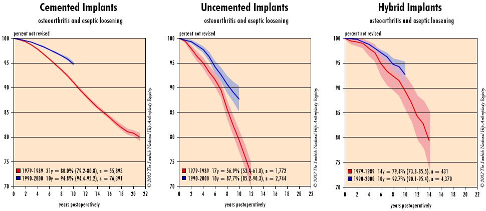 implantes ortopédicos taxas de revisão para pacientes com uma actividade moderada, um bom implante da anca pode durar entre 15 a 20 anos e para os pacientes