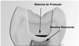 (poucos dias) Facilidade de uso Fácil Base (sob amálgama) Facilidade de remoção Fácil Forramento Base Vedamento marginal Bom Biocompatibilidade Ação anódina (Sedativa) RESUMO Base (sob amálgama)