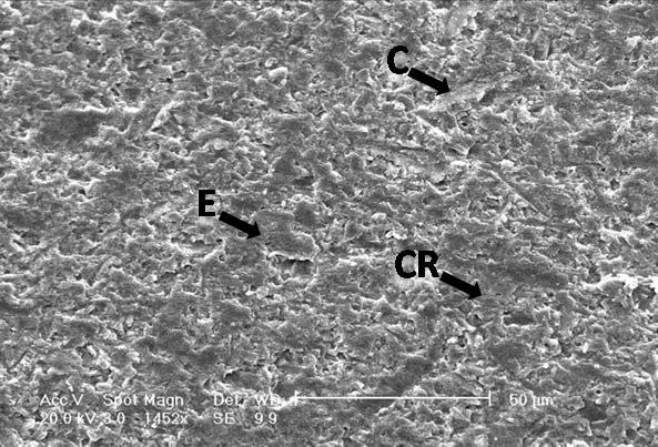 55 As superfícies irradiadas com laser de Nd:YAG apresentaram um padrão de retenção micromecânica com áreas de melting, com elevações, presença de crateras e poros heterogêneos e com pequenos