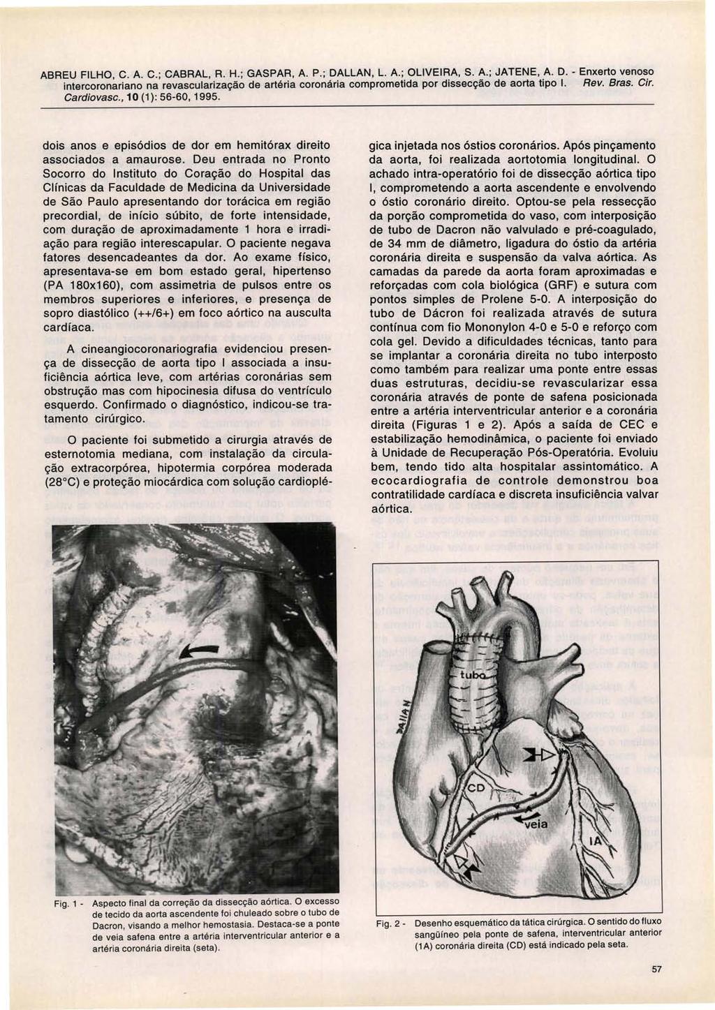 Cardiovasc., 10 (1) : 56-60, 1995. dois anos e episódios de dor em hemitórax direito associados a amaurose.