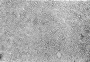 RT-PCR, RT-PCR em