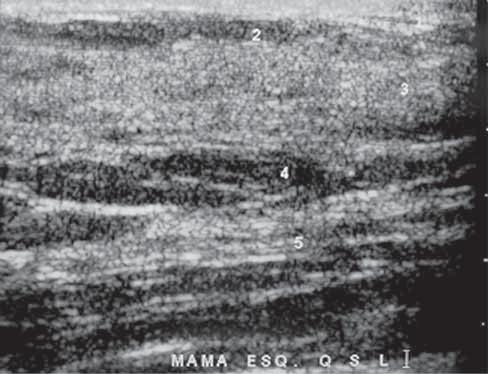 Ressalta-se que o exame ultra-sonográfico, sempre que possível, deve ser realizado orientado pela, uma vez que a associação deste métodos com o exame clínico amplia a possibilidade de detecção de