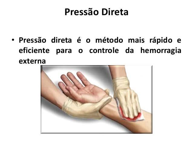 Controlar a hemorragia: 1. Pressão direta é aplicar pressão no local do sangramento.