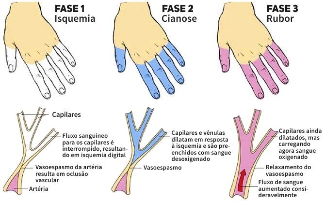 C ) Perfusão O socorrista pode obter uma avaliação geral do estado circulatório do doente verificando o pulso, a cor, a temperatura e umidade da pele e o tempo de