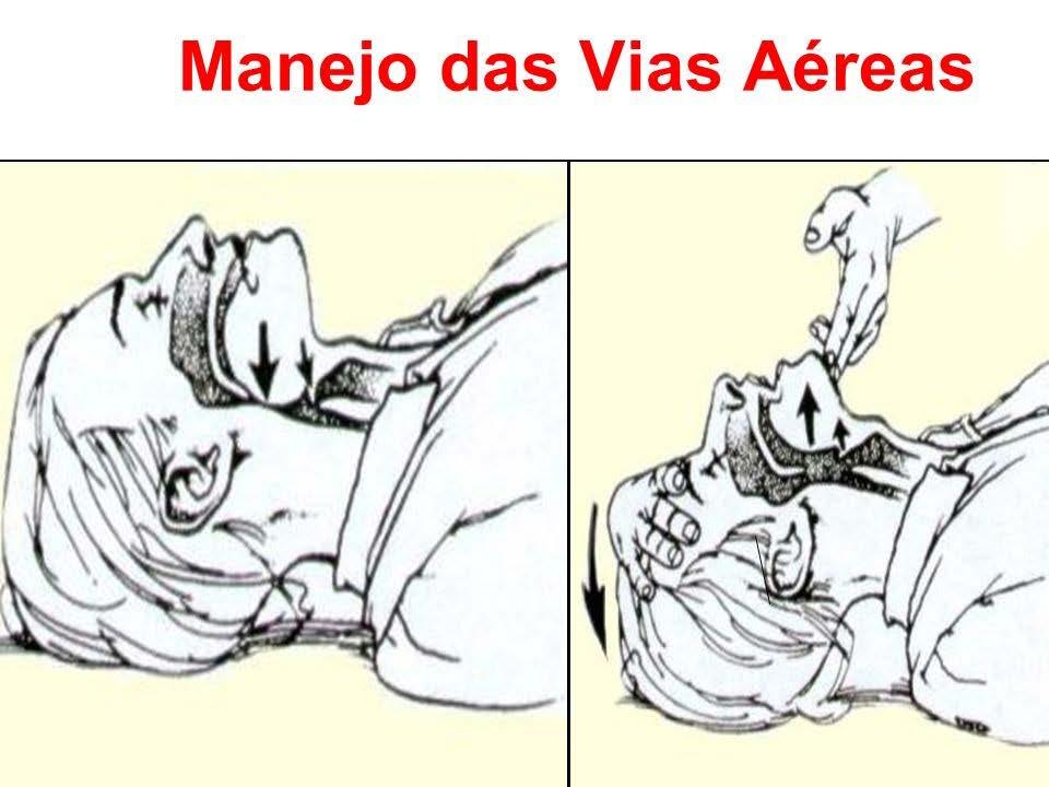 A B C D E A) Vias Aéreas - As vias aéreas devem ser rapidamente verificadas para assegurar que estão abertas e limpas e que não existe perigo de obstrução.