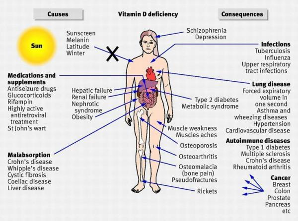 Vitamina D: Causas e Consequências Vitamina D: Níveis e Estado de Saúde Serum 25-Hydroxyvitamin D [25(OH)D] Concentrations and Health* - IOM nmol/l** ng/ml* Health status <30 <12 Associated with