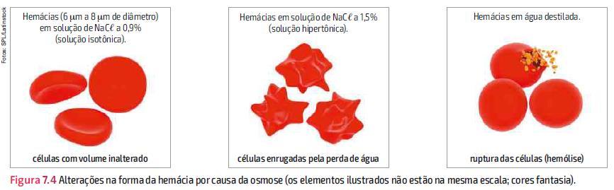 OSMOSE NAS CÉLULAS ANIMAIS Se uma hemácia, for mergulhada em uma solução hipertônica em relação ao seu citoplasma, ela perderá água por osmose e murchará (crenação).