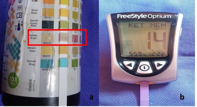 testes foram realizados imediatamente após a coleta.