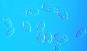 Ciliospora: os ciliados Durante algum estágio da vida apresenta cílios O mais conhecido e de maior