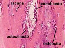 Cartilaginoso