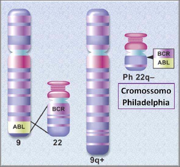 17 1.1.2 Fisiopatologia A Biologia Molecular da LMC A descoberta do cromossomo Philadelphia (Ph 1 ), em 1960, como a primeira anomalia cromossômica consistente associada a um tipo específico de