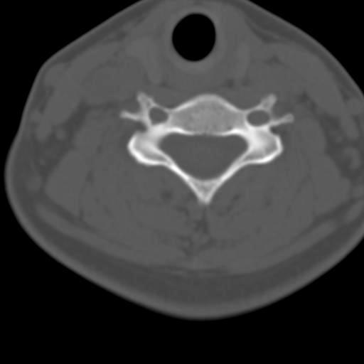 ANATOMIA TOPOGRÁFICA