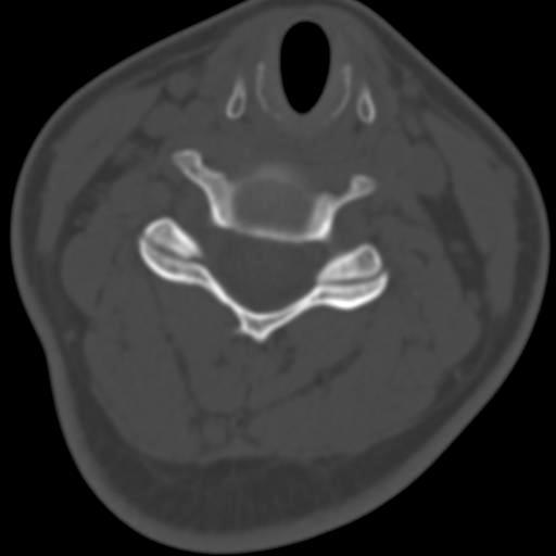 ANATOMIA TOPOGRÁFICA articulações