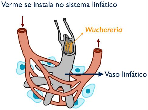 Profilaxia Oxiurose - caseira Agente etiológico: Transmissão: Profilaxia: Bicho