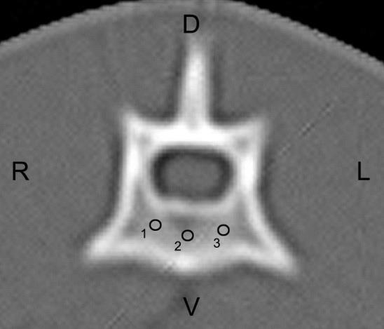 43 standardize the levels of the sections and to obtain the radiodensity measurements of the bone tissue at the different experimental stages, similar visualization of the spinous and transversal