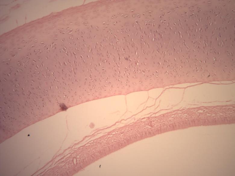 LÂMINA C1 TRAQUÉIA HE AULA PRÁTICA DE SISTEMA RESPIRATÓRIO IMAGENS: Historep LÂMINA P1 PULMÃO HE Apresenta mucosa com tecido epitelial pseudoestratificado cilíndrico ciliado com células caliciformes