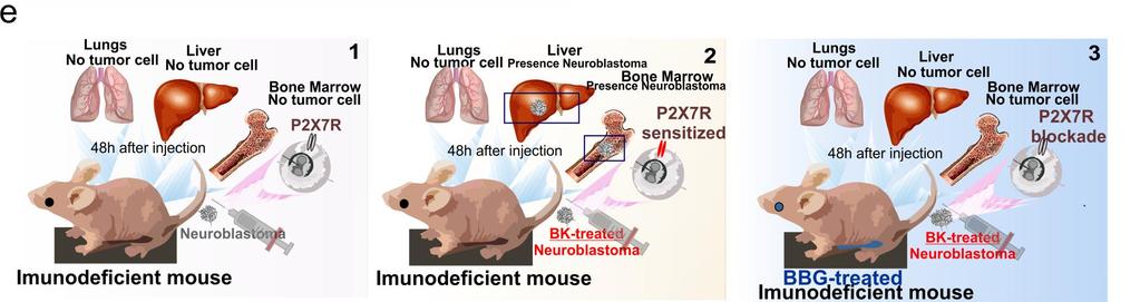 Metástase: Bradicinina X ATP Brilliant Blue G - BBG: antagonista do receptor P2X7 Efeitos do BBG na progressão do tumor Injeção de células humanas na veia caudal de camundongos imunodeficientes.