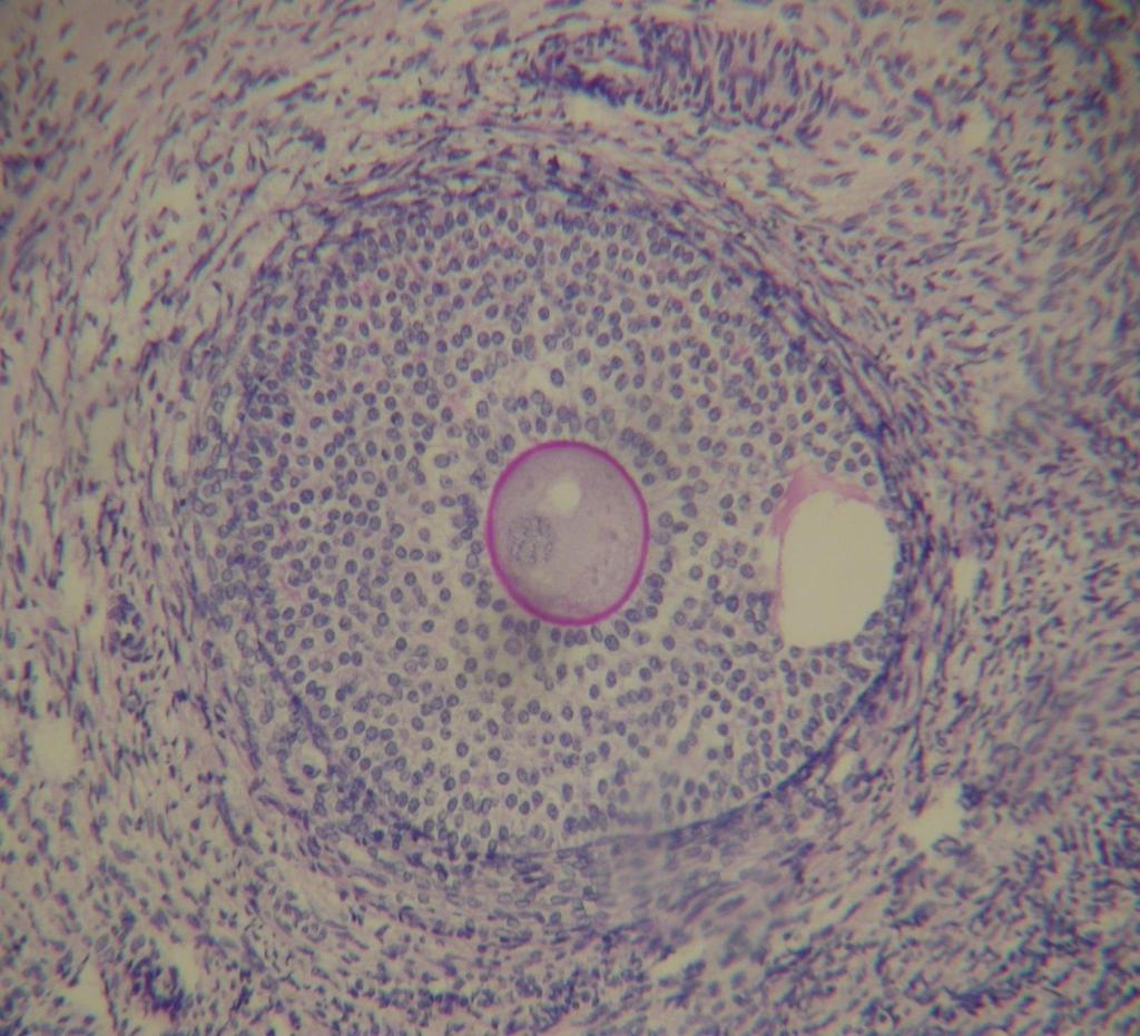 FOLICULOGÊNESE Folículo Secundário Vesicular Inicial (Terciário