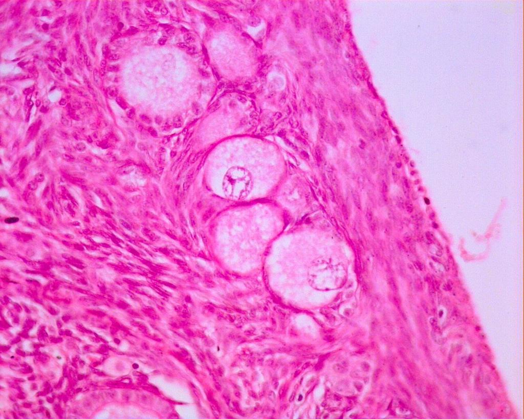 Folículo Primário Unilaminar (Ovócito