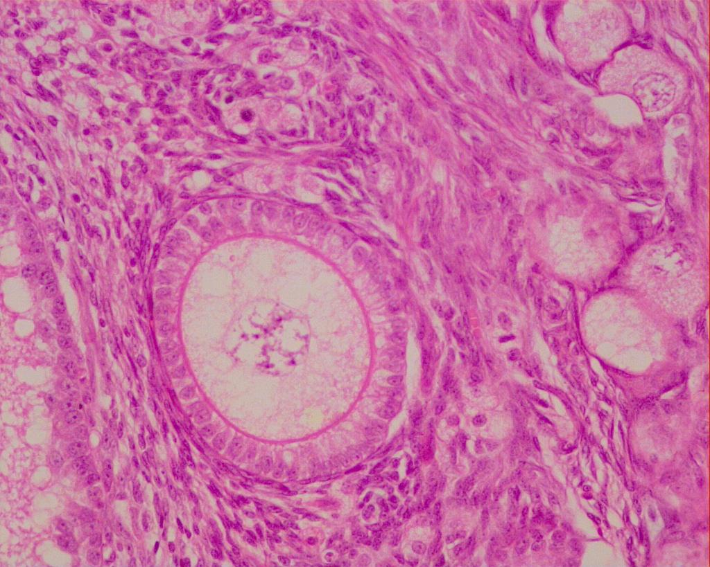 Folículo Primário Multilaminar