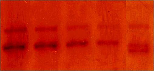 5 Resultados 43 N1 C12 C20 C21 C23 N1 C20 C21 C23 (a) (b) (c) Ilustração 9 Triagem de mutações em gel de poliacrilamida pela técnica de SSCP. (a) Gel de poliacrilamida 6%, com 12 horas de corrida.