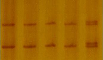 Para o fragmento correspondente ao exon 18 do gene COL1A2, a triagem de alterações genéticas permitiu a