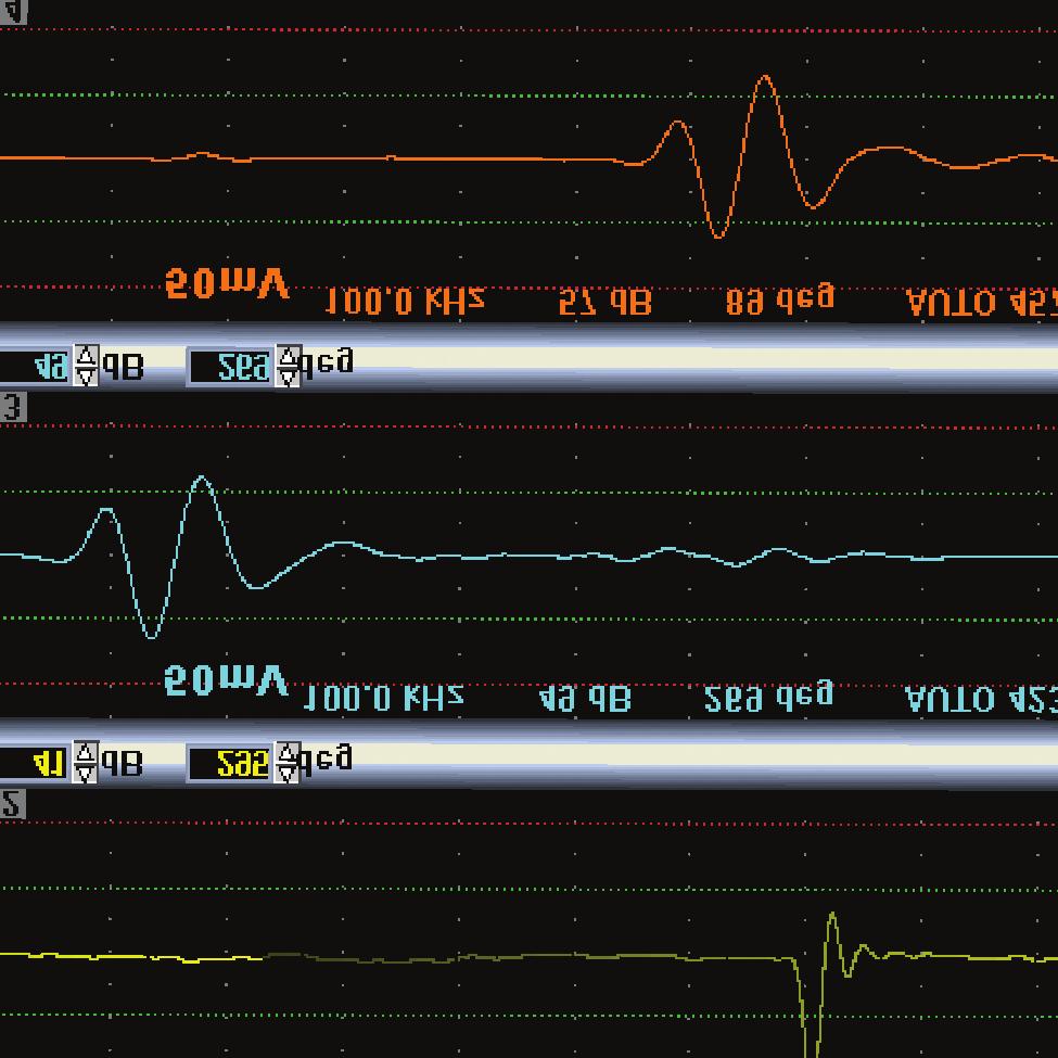 Tela Multi Mostra os resultados simultâneos nos modos polar e linear e até oito canais de teste incluindo os limiares de aceitação Mostra claramente se os sinais de defeitos ultrapassam os