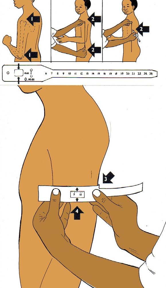 Medição do Perímetro Braquial 1. Peça a pessoa para dobrar o seu braço fazendo um ângulo de 90 graus. 2. Localize o ponto intermédio do braço esquerdo, entre o ombro e o cotovelo.