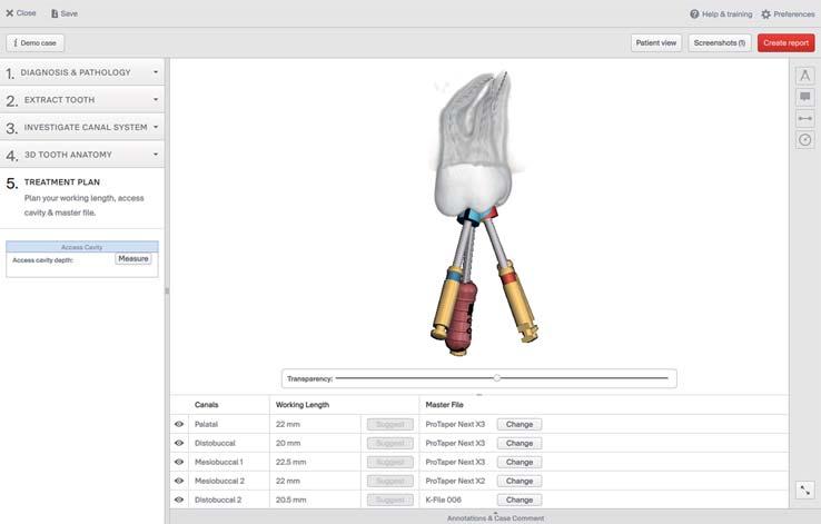 3D Endo TM Software