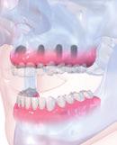 constitui é frequentemente um desafio para o médico dentista.