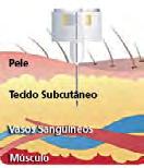 Mantenha os dedos a uma pequena distância do ponto de aplicação e insira a