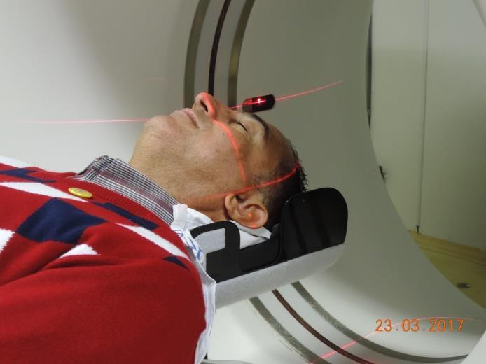 Posicionamento no suporte de crânio: Laser