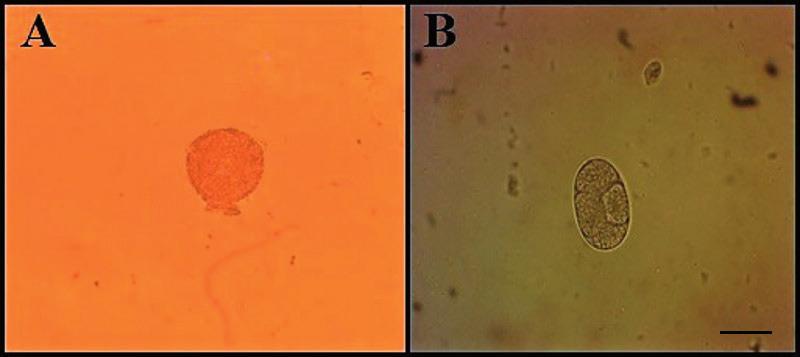 Figura 1. Prancha fotomicrográfica dos parasitos intestinais identificados nas fezes da Bugio-preta (Alouatta caraya). A- Ovo de Ascaris sp., identificado por meio da técnica HPJ (Obj. 40x).