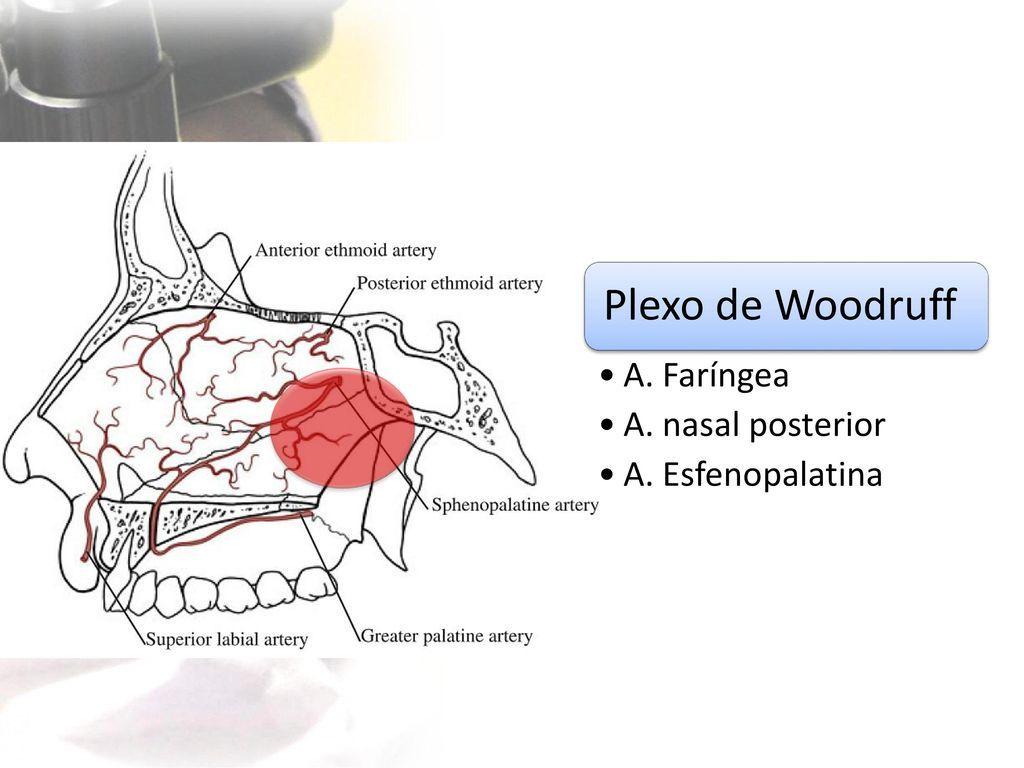 sanguíneos na mucosa nasal, podendo ser espontâneo ou por trauma.