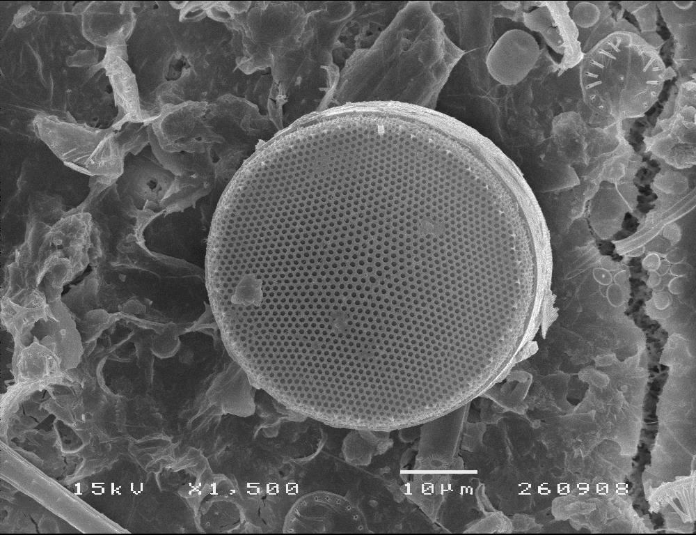 Diatomácea observada ao microscópio electrónico de