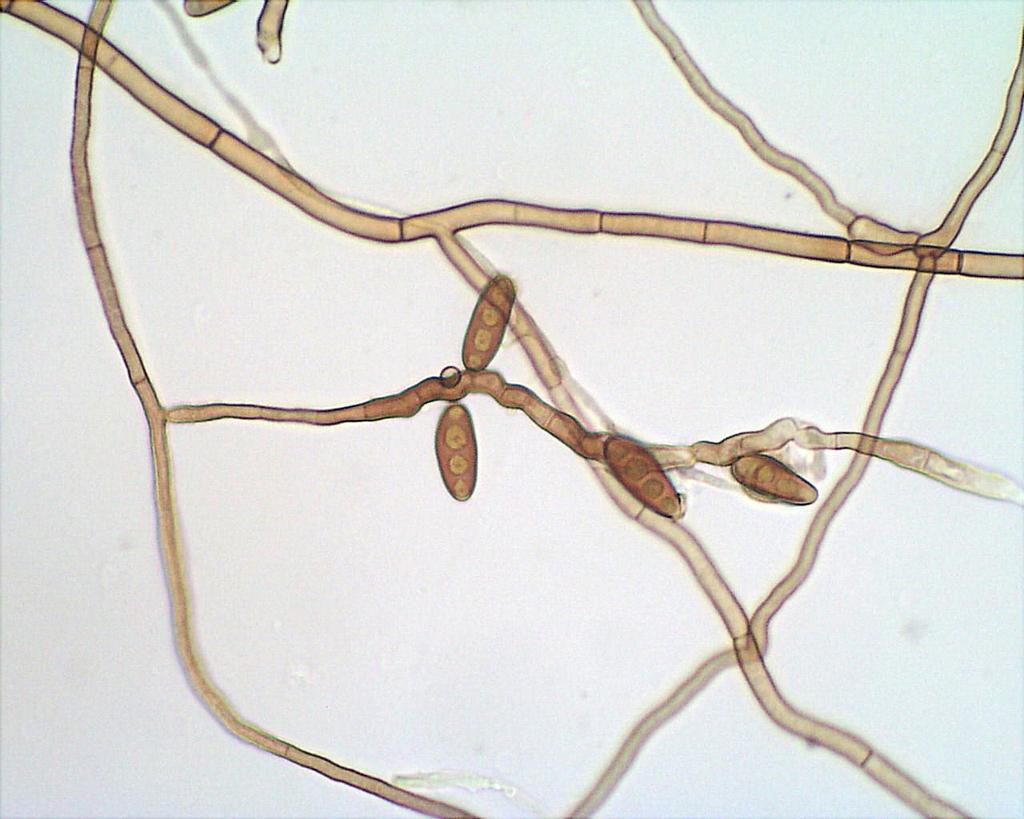 DRECHSLERA SPP.