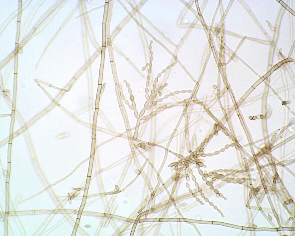 LACTOFENOL DE AMAN CLADOSPORIUM