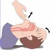 Desobstrução das vias aéreas Manobra de inclinação da cabeça e elevação do queixo (atualmente mais usada).