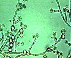CARACTERÍSTICAS MORFOLÓGICAS microscópico: micélio vegetativo: desenvolve-se no interior do substratoelemento de