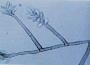 micélio vegetativo: nutrição e fixação não possuem tecidos