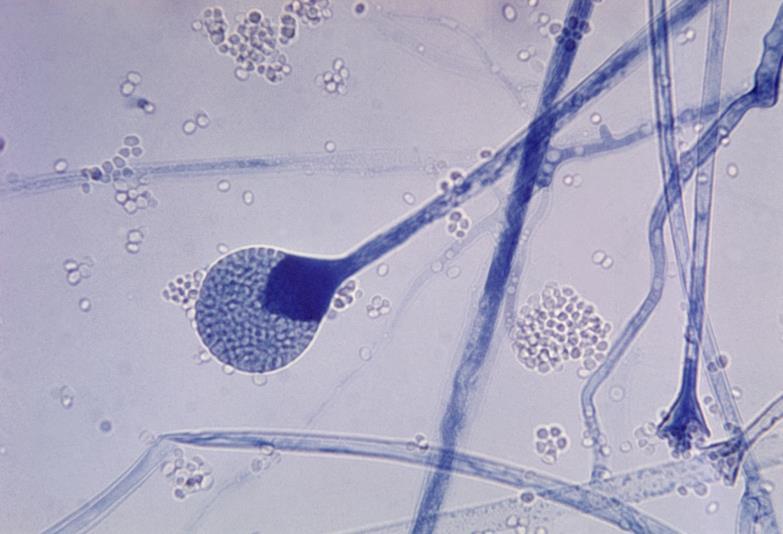 Mucor Hifas não septadas; Reprodução por esporangiósporos;