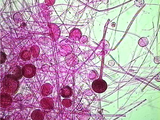 Rhizopus Hifas não septadas; Reprodução por esporangiósporos;