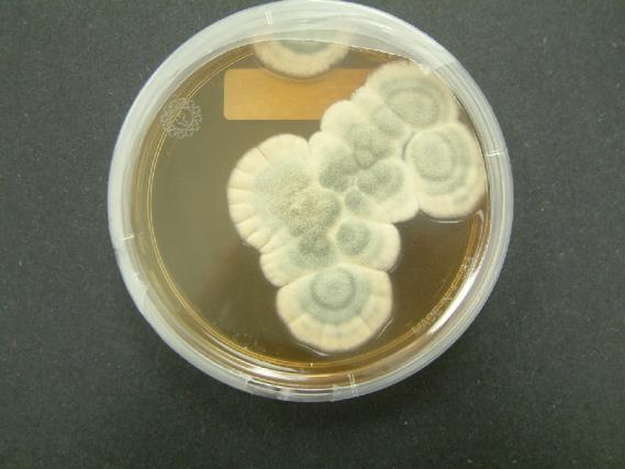 Penicillium Muito comuns; Esverdeados; Conídios em rosário; Existem formas