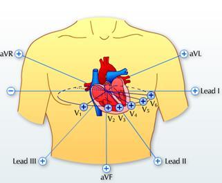 Normalmente, os eletrodos são colocados na superfície do tórax e dos membros, mas existem