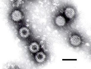 Rotavírus VIRULÊNCIA Família : Reoviridae Vírus não envelopado de 60-80 nm Genoma de RNA (ds) segmentado Sete tipos: A-G O rotavírus é o principal vírus causador de diarréia em crianças.